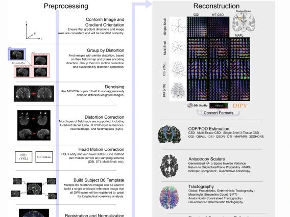 Image of QSIprep information